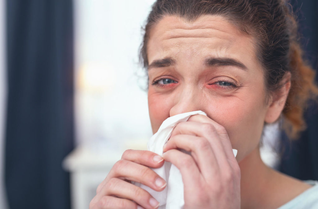A woman is wiping her nose and has red eyes due to allergies.