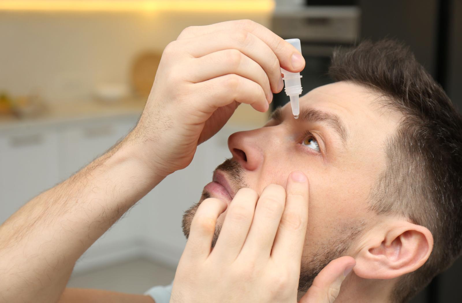 A person inserting eye drops to minimize the effects of eye allergies.